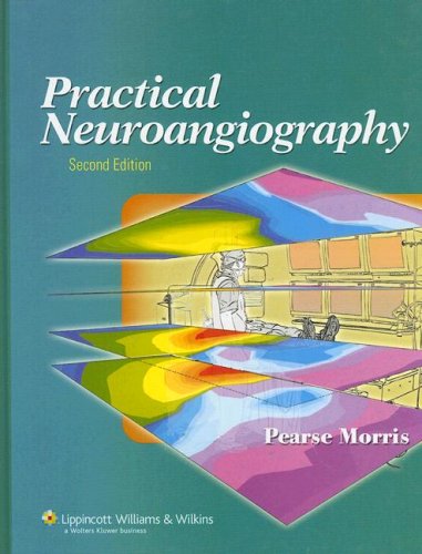 Stock image for Practical Neuroangiography for sale by SecondSale