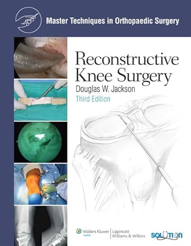 Imagen de archivo de Reconstructive Knee Surgery a la venta por Better World Books