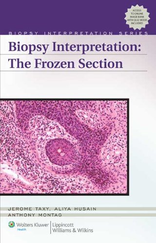 Stock image for Biopsy Interpretation: The Frozen Section (Biopsy Interpretation Series) for sale by Books of the Smoky Mountains