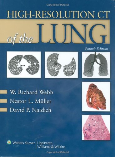 9780781769099: High-resolution CT of the Lung