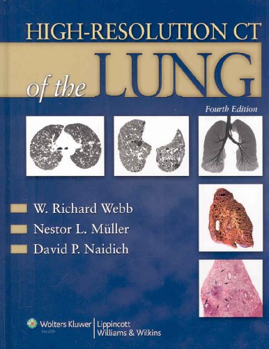 Stock image for High-Resolution CT of the Lung for sale by Your Online Bookstore