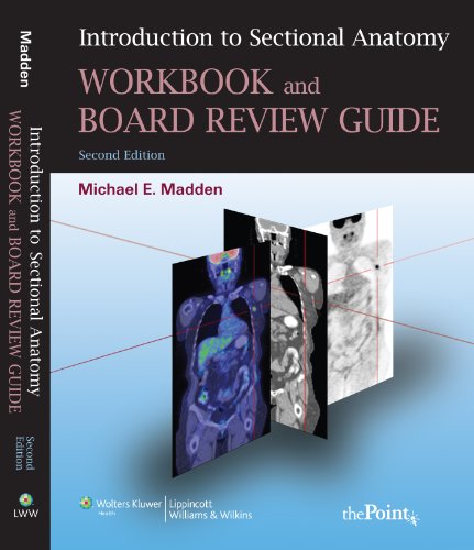 Imagen de archivo de Introduction to Sectional Anatomy Workbook and Board Review Guide (Point (Lippincott Williams & Wilkins)) a la venta por SecondSale