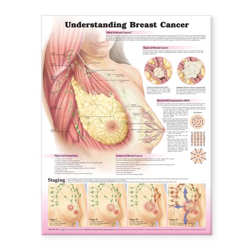 Understanding Breast Cancer Anatomical Chart (9780781772228) by Anatomical Chart Company