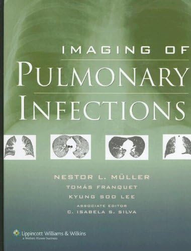 Imagen de archivo de Imaging of Pulmonary Infections a la venta por Better World Books