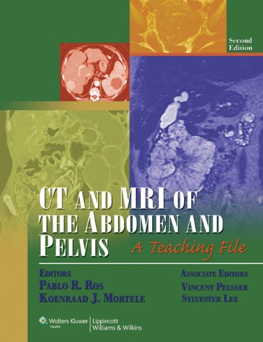 Stock image for CT and MRI of the Abdomen and Pelvis: A Teaching File (LWW Teaching File Series), 2e for sale by HPB-Red