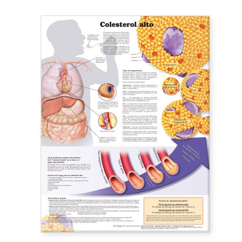 High Cholesterol/Colesterol Alto Anatomical Chart (Spanish Edition) (9780781773058) by Anatomical Chart Company