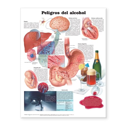 Peligros Del Alcohol Carta Anatomica (Spanish Edition) (9780781773355) by Anatomical Chart Company