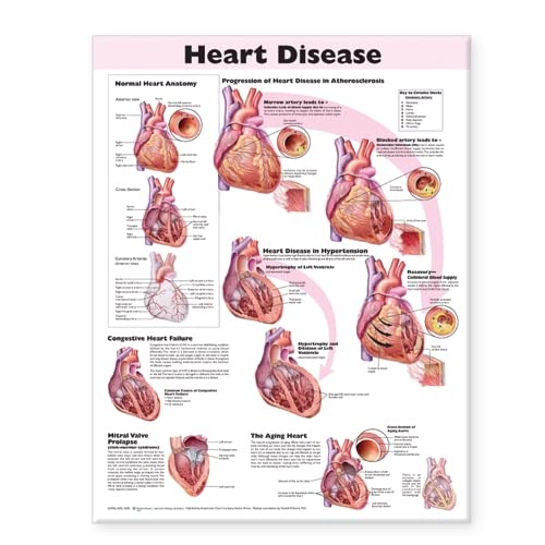 9780781773386: Heart Disease Anatomical Chart
