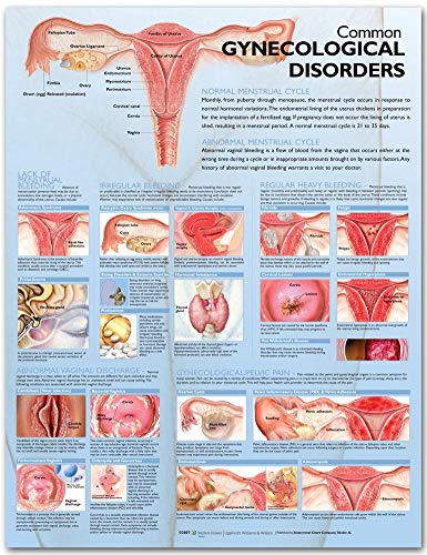 Imagen de archivo de Common Gynecological Disorders Anatomical Chart a la venta por Revaluation Books