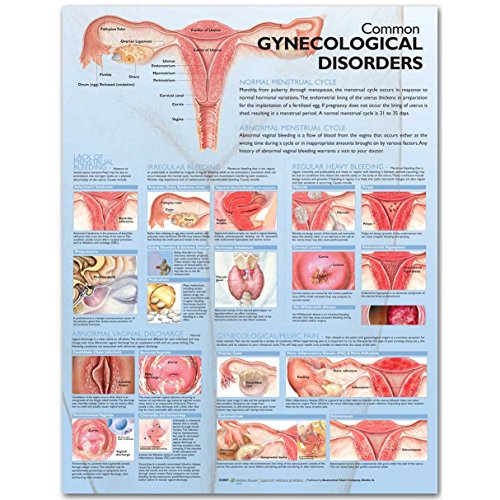 Stock image for Common Gynecological Disorders Anatomical Chart for sale by Revaluation Books