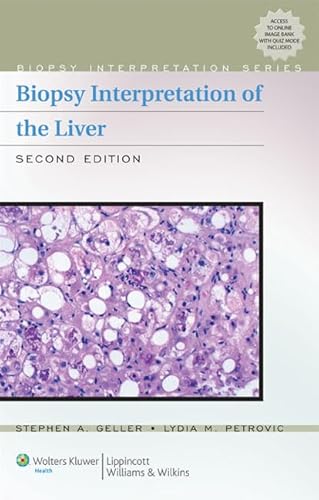 9780781774680: Biopsy Interpretation of the Liver (Biopsy Interpretation Series)