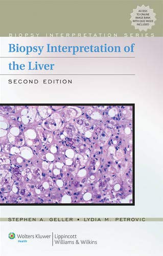 9780781774680: Biopsy Interpretation of the Liver (Biopsy Interpretation Series)