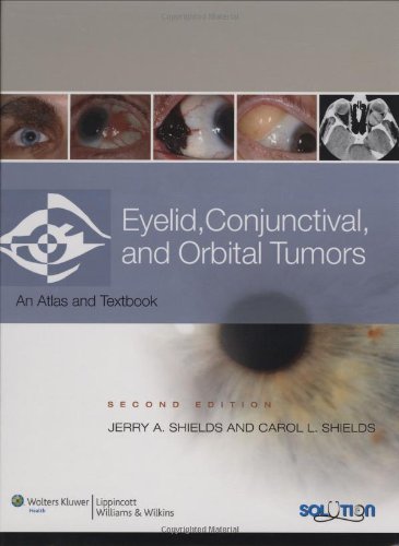 Imagen de archivo de Eyelid, Conjunctival, and Orbital Tumors : An Atlas and Text a la venta por Better World Books: West