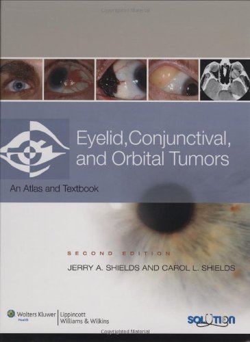 9780781775786: Eyelid, Conjunctival, and Orbital Tumors: An Atlas and Text