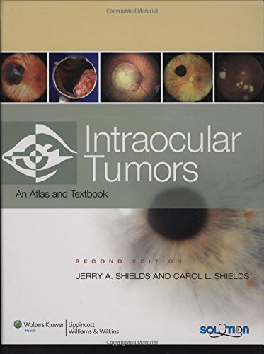 Stock image for Intraocular Tumors: An Atlas and Text for sale by Solr Books