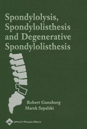 Beispielbild fr Spondylosis, Spondylolisthesis and Degenerative Spondylolisthesis zum Verkauf von Book Bear