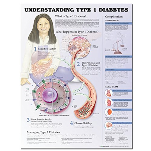 Understanding Type 1 Diabetes Anatomical Chart (9780781776622) by Anatomical Chart Company
