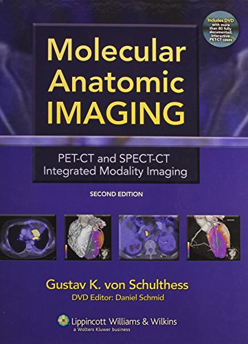 Stock image for Molecular Anatomic Imaging: Pet-Ct and Spect-Ct Integrated Modality Imaging for sale by Anybook.com