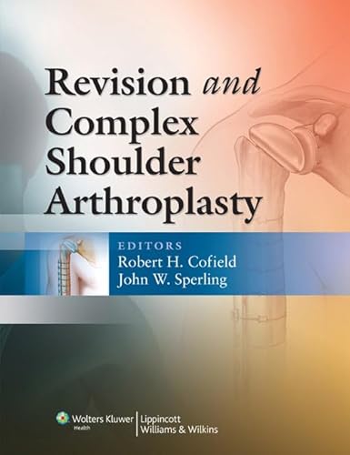 9780781777476: Revision and Complex Shoulder Arthroplasty