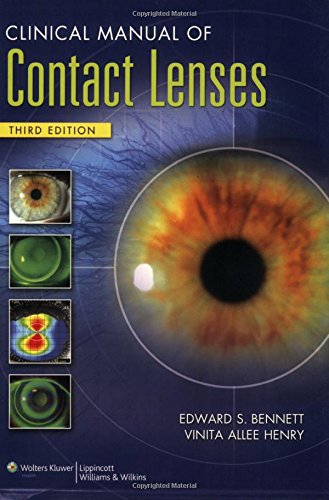 Beispielbild fr Clinical Manual of Contact Lenses zum Verkauf von Better World Books