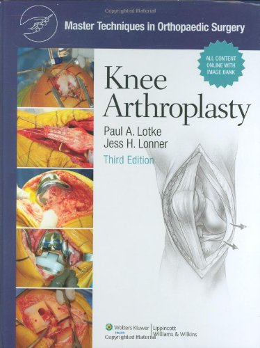 Imagen de archivo de Master Techniques in Orthopaedic Surgery, Knee Arthroplasty a la venta por Seattle Goodwill