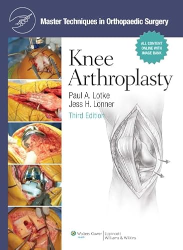Stock image for Master Techniques in Orthopaedic Surgery, Knee Arthroplasty for sale by Seattle Goodwill