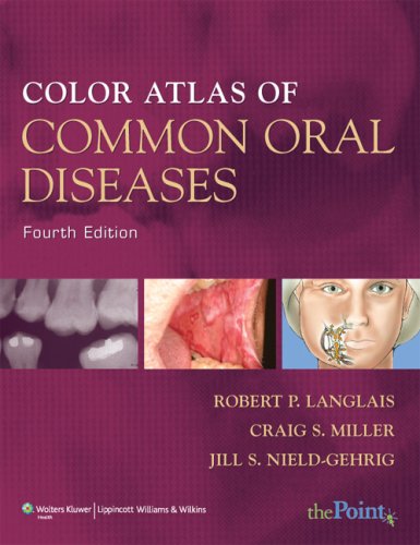 9780781780971: Color Atlas of Common Oral Diseases