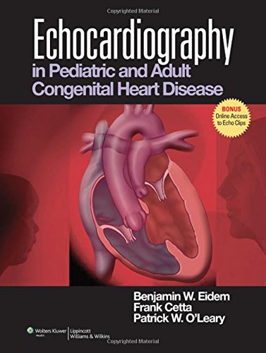 9780781781367: Echocardiography in Pediatric and Adult Congenital Heart Disease