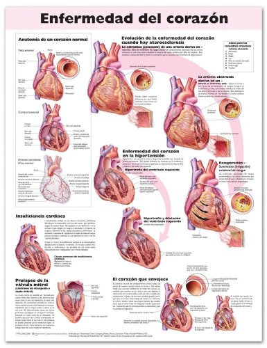 9780781782180: Enfermedad del Corazon Anatomical Chart / Heart Disease Anatomical Chart (Spanish Edition)