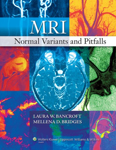 Imagen de archivo de MRI Normal Variants and Pitfalls a la venta por Better World Books