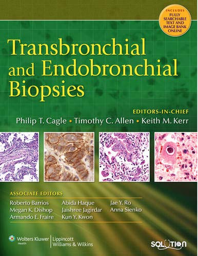 9780781785174: Transbronchial and Endobronchial Biopsies