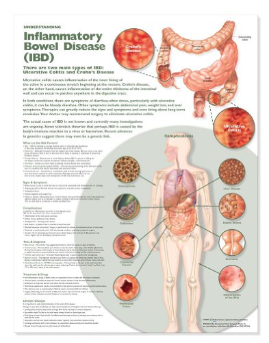 Understanding Inflammatory Bowel Disease (IBD) Anatomical Chart (9780781786485) by Anatomical Chart Company