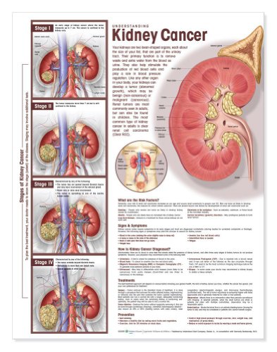 Understanding Kidney Cancer Anatomical Chart, Paper (9780781786508) by Anatomical Chart Company