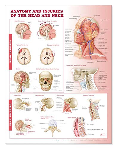 Imagen de archivo de Anatomy and Injuries of the Head and Neck Anatomical Chart a la venta por Revaluation Books