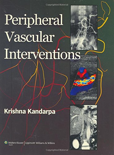 9780781786874: Peripheral Vascular Interventions