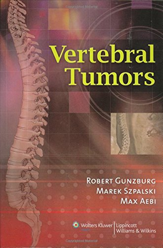 Stock image for Vertebral Tumors for sale by Buyback Express