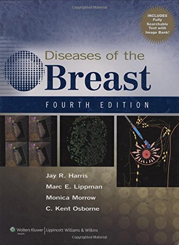 Beispielbild fr Diseases of the Breast zum Verkauf von Better World Books