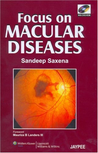 9780781791298: Focus on Macular Diseases: Co-Published by Jaypee Brothers and Lippincott Williams & Wilkins