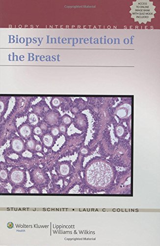 Stock image for Biopsy Interpretation of the Breast (Biopsy Interpretation Series) for sale by HPB-Red
