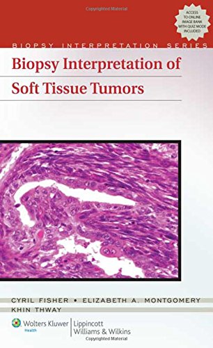 9780781795593: Biopsy Interpretation of Soft Tissue Tumors (Biopsy Interpretation Series)