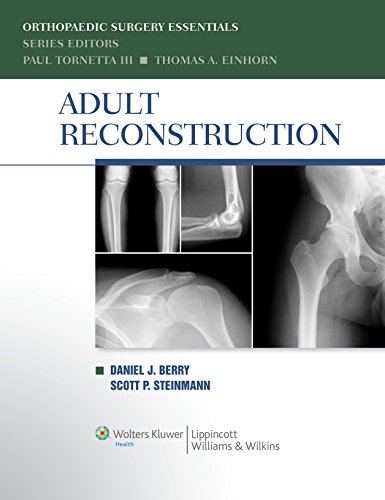 Stock image for Adult Reconstruction for sale by Better World Books