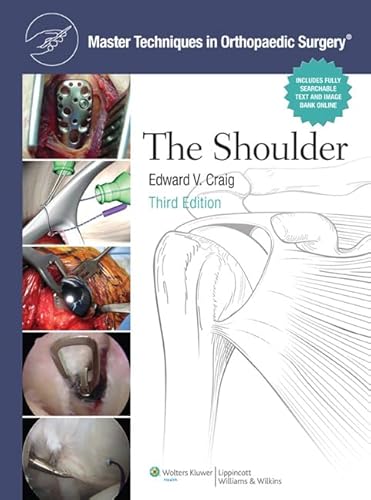 Stock image for Master Techniques in Orthopaedic Surgery: Shoulder for sale by ThriftBooks-Atlanta