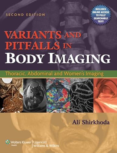 Stock image for Variants and Pitfalls in Body Imaging: Thoracic, Abdominal and Women's Imaging for sale by Wizard Books