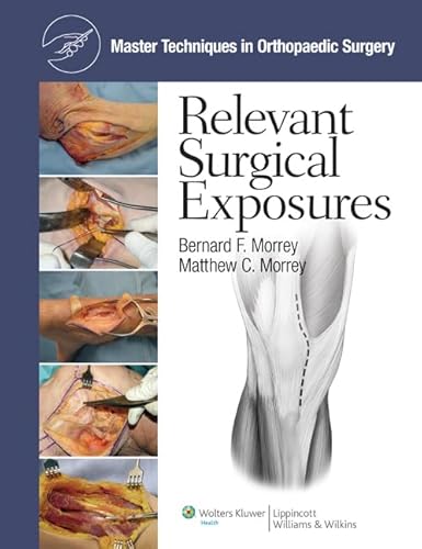 Beispielbild fr Master Techniques in Orthopaedic Surgery: Relevant Surgical Exposures (Master Techniques in Orthopaedic Surgery): Relevant Surgical Exposures (Master Techniques in Orthopaedic Surgery) zum Verkauf von AwesomeBooks