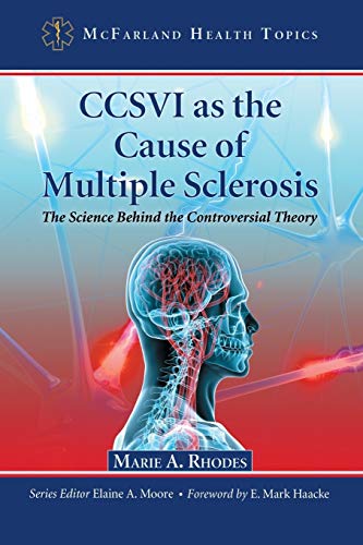 CCSVI as the Cause of Multiple Sclerosis : The Science Behind the Controversial Theory