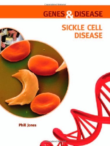 Stock image for Sickle Cell Disease for sale by ThriftBooks-Atlanta