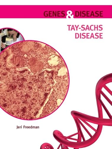 Beispielbild fr Tay-Sachs Disease zum Verkauf von Better World Books