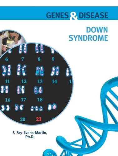 Beispielbild fr Down Syndrome zum Verkauf von Better World Books