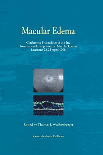 Macular Edema (Ophthalmologica)