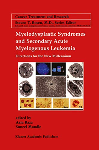 Beispielbild fr Myelodysplastic Syndromes & Secondary Acute Myelogenous Leukemia: Directions for the New Millennium (Cancer Treatment and Research, 108) zum Verkauf von Wonder Book